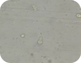 สาเหตุ ชูก้าท้องเสีย